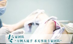 人流前注意事项